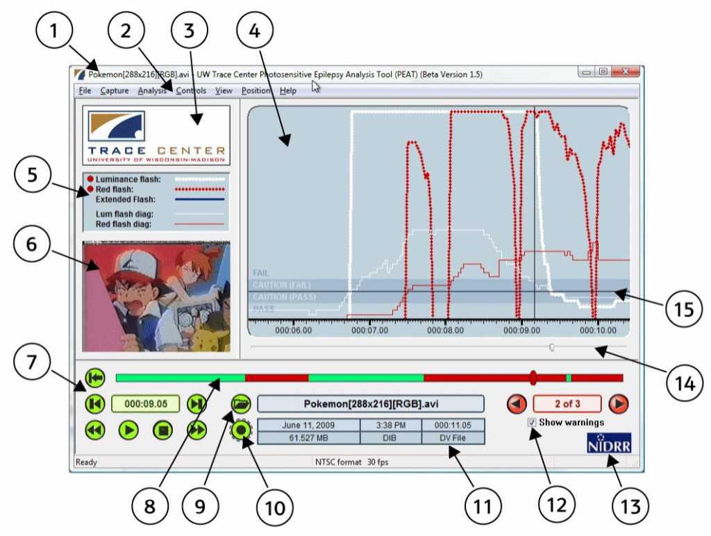 Photosensitive Epilepsy Analysis Tool (PEAT) User Guide - TRACE RERC